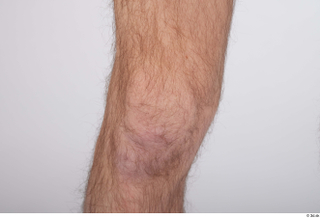 Dio hairy knee nude 0004.jpg